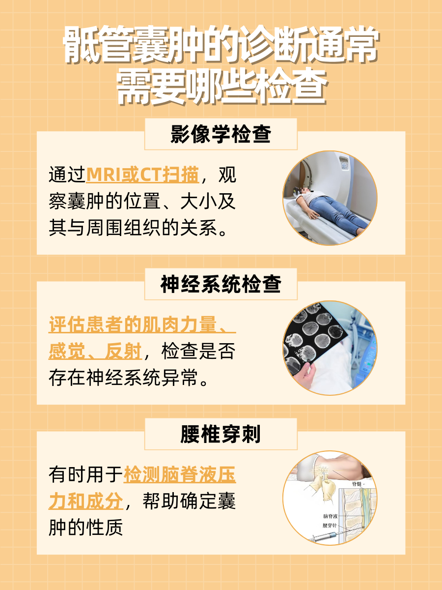 骶管囊肿预警四种病,你不得不防!