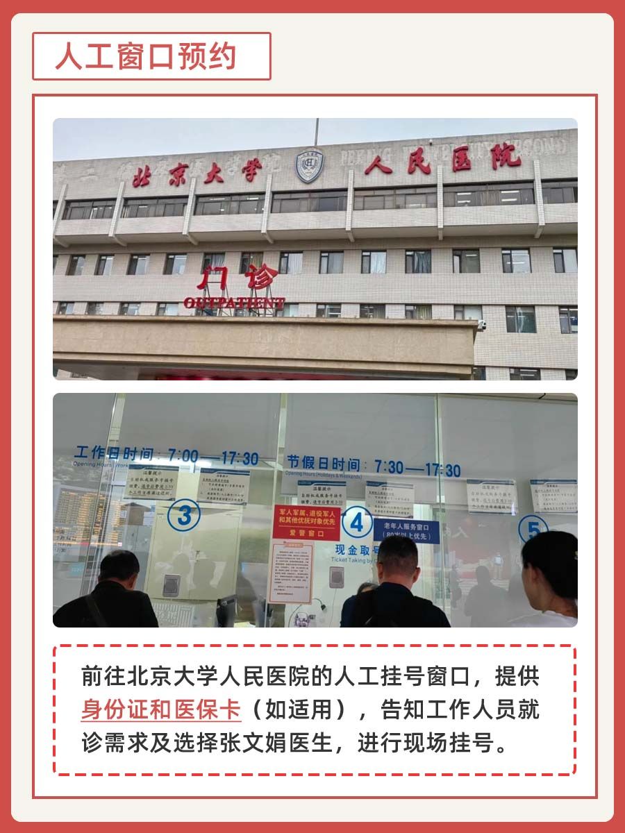 北大人民医院张文娟医生怎么样?怎么挂号?