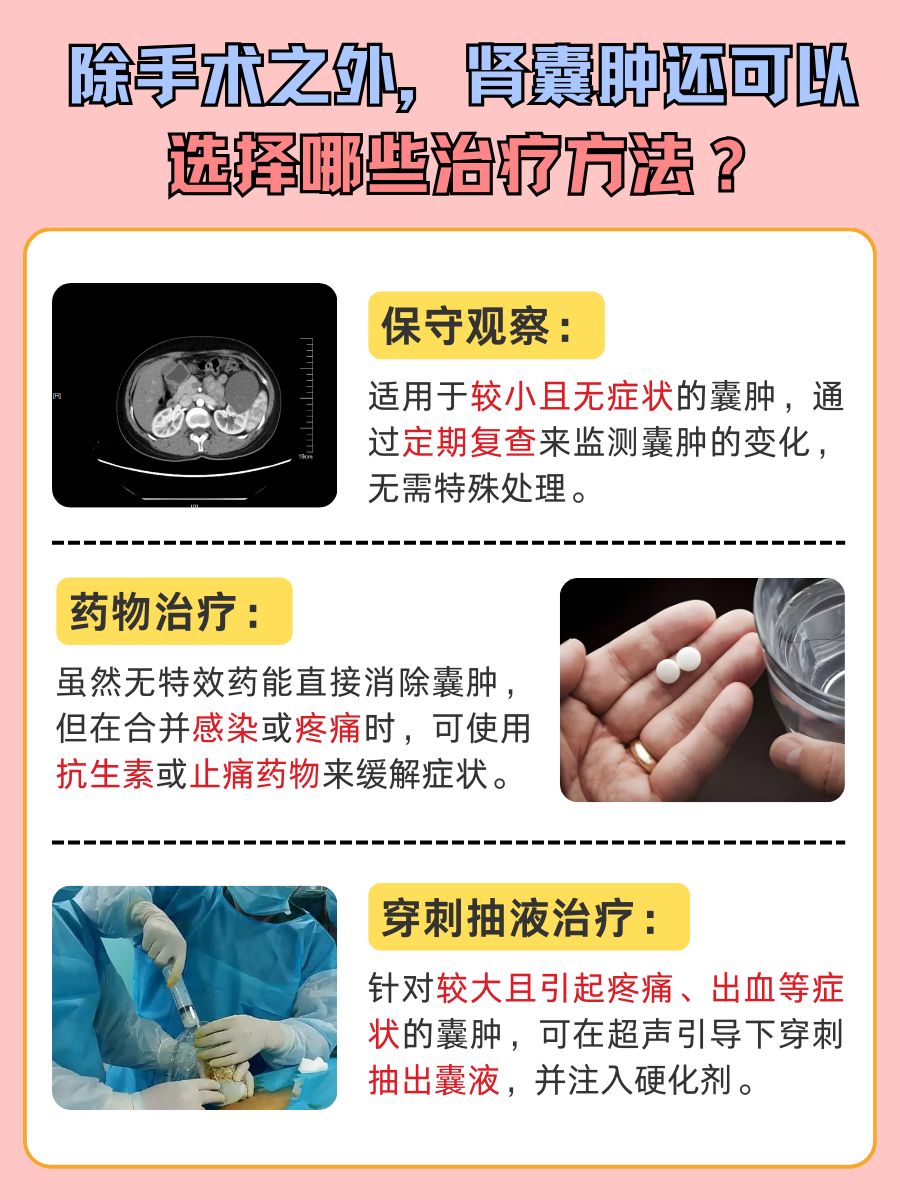 肾囊肿多大需要做手术？医生告诉你答案