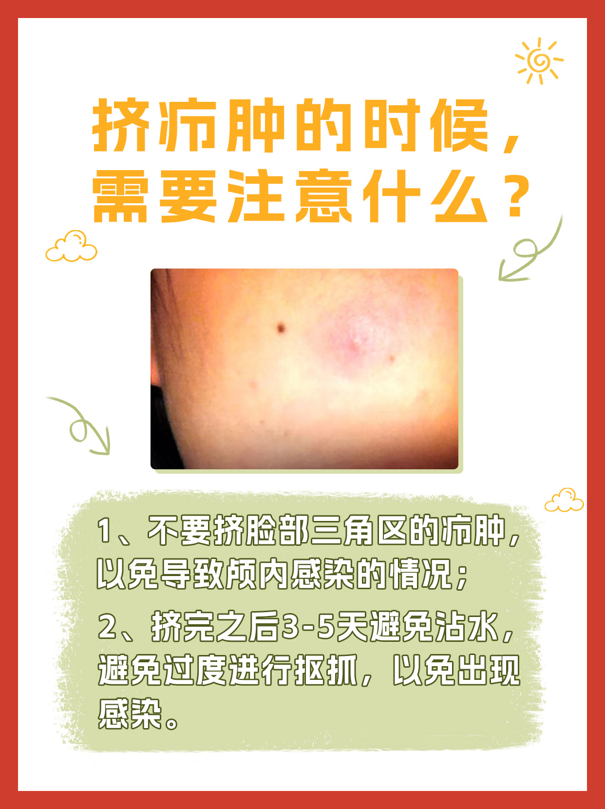 挤疖肿技巧:何种程度才算干净?