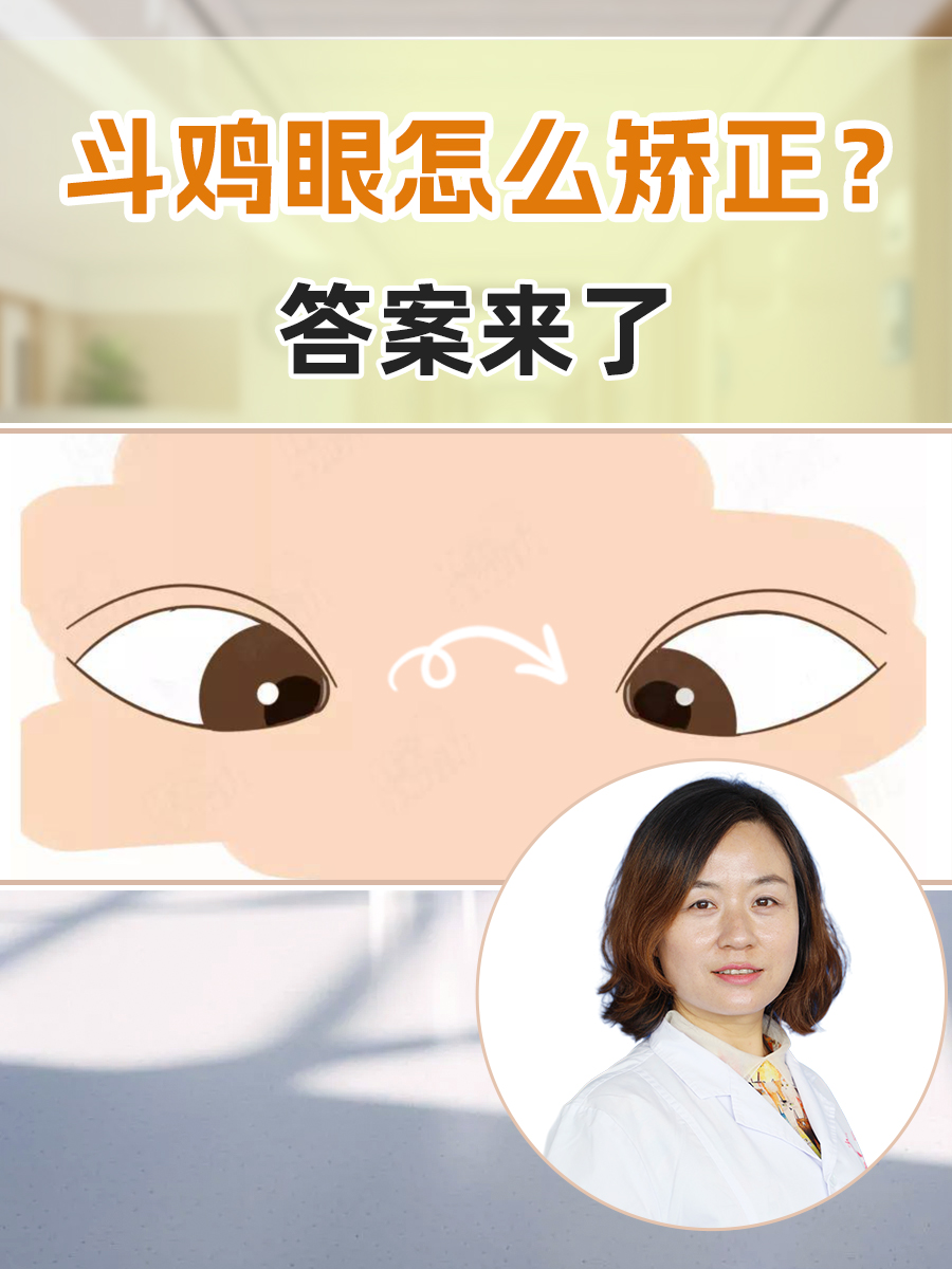 斗鸡眼怎么矫正？答案来了