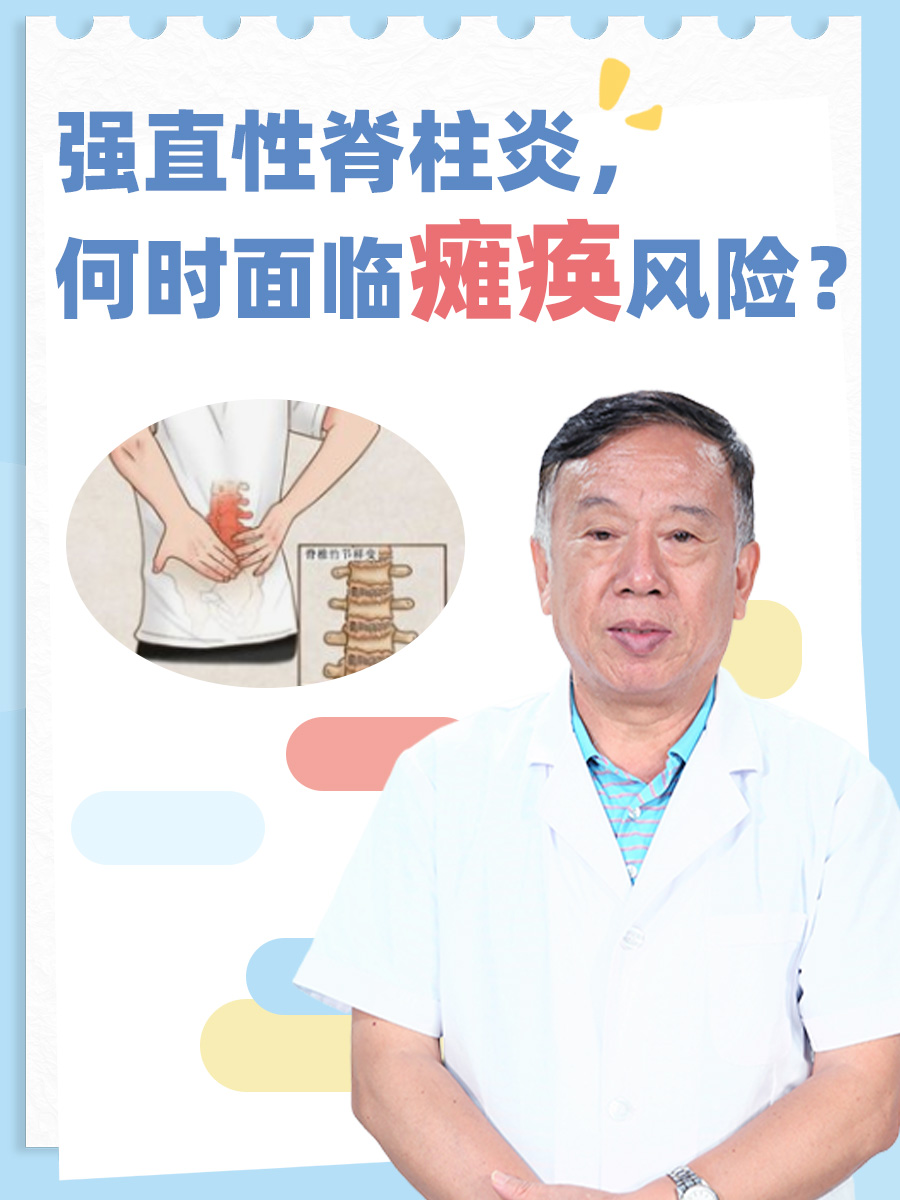 强直性脊柱炎，何时面临瘫痪风险？