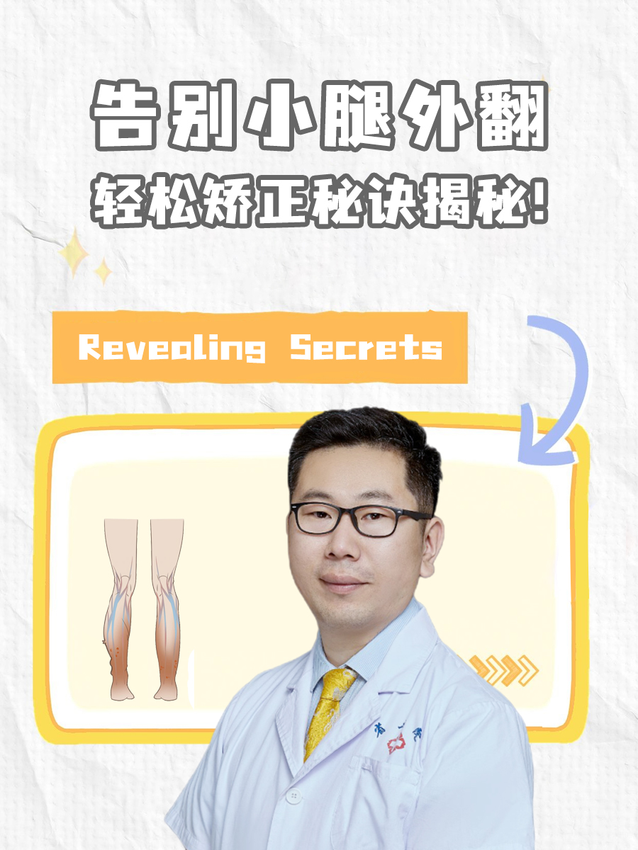 告别小腿外翻,轻松矫正秘诀揭秘!