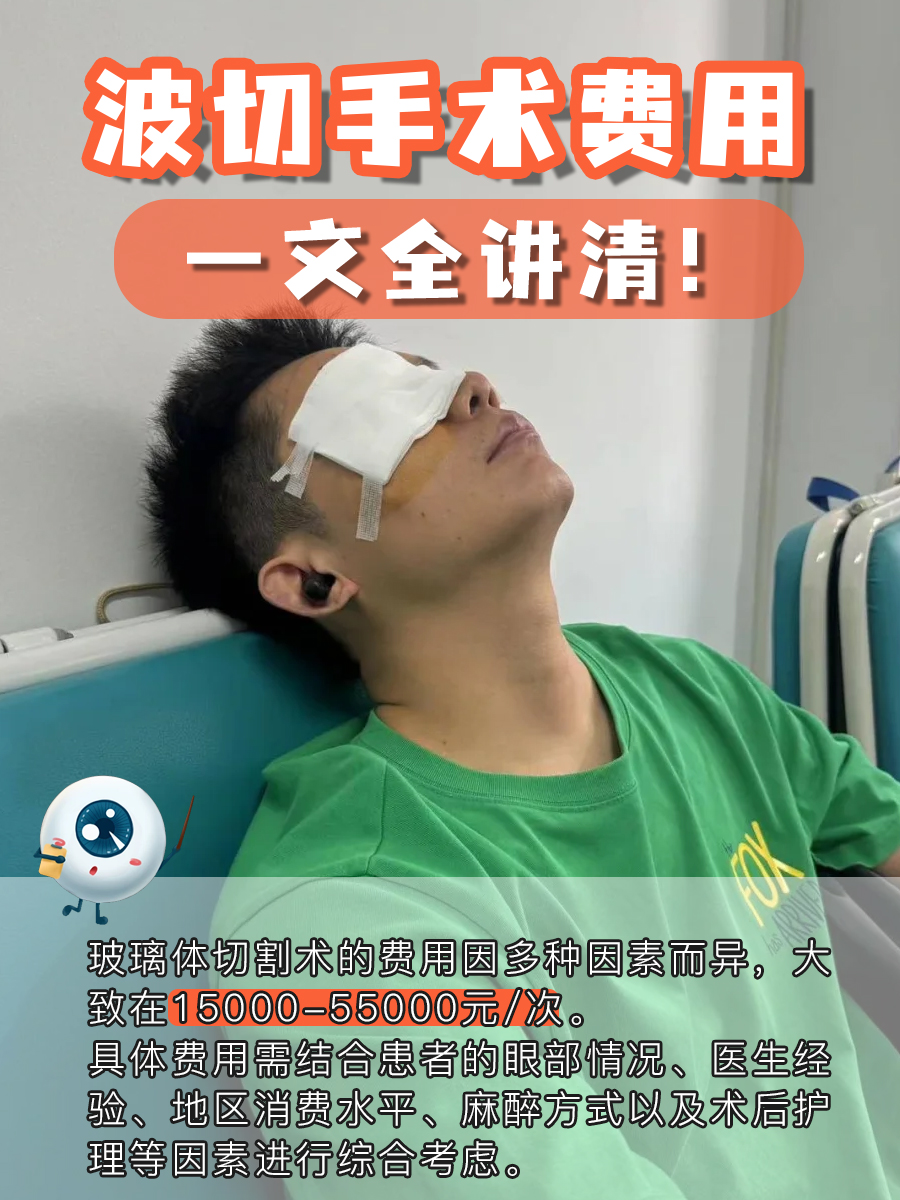 波切手术费用，一文全讲清！