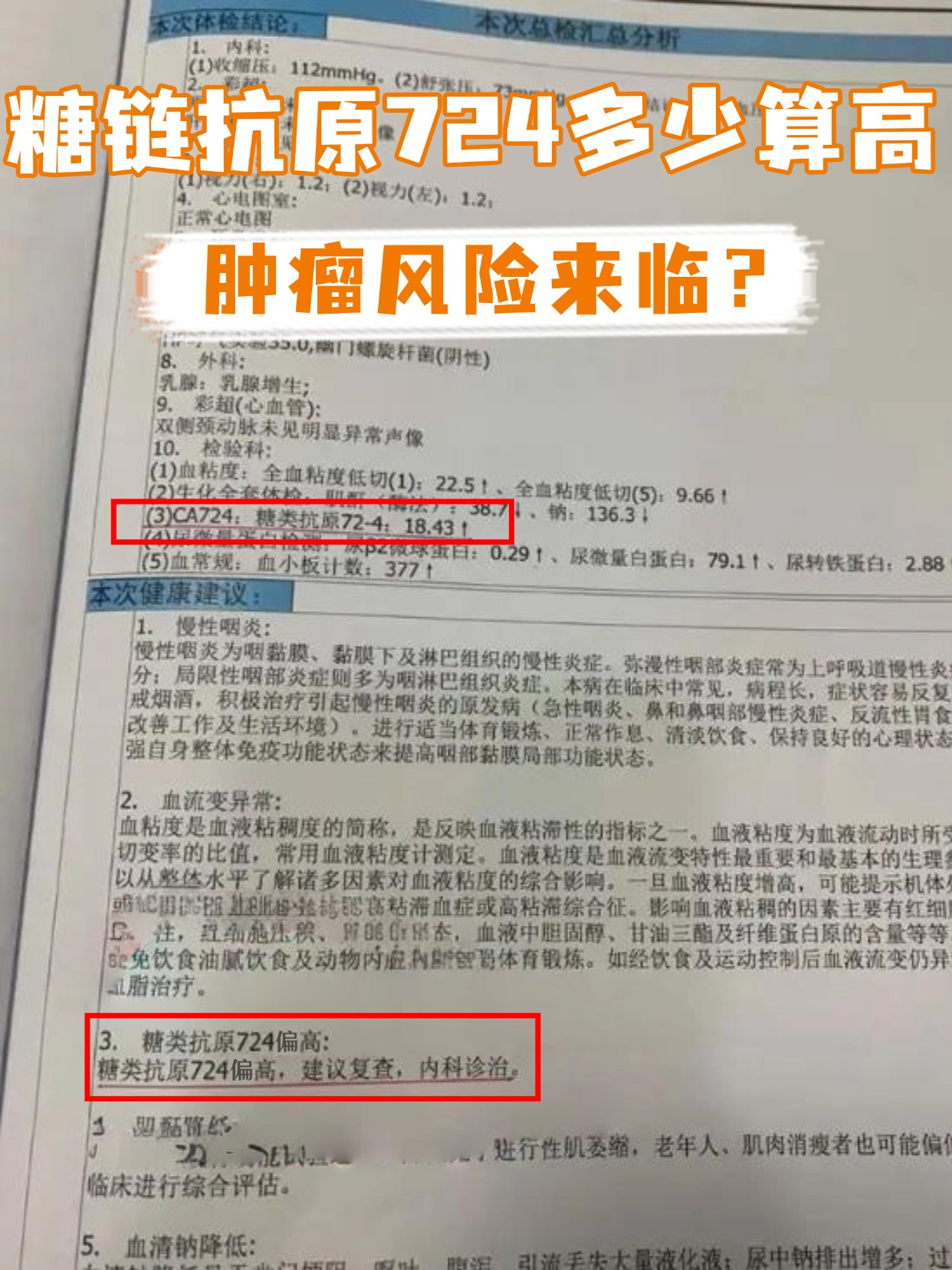 糖链抗原724多少算高，肿瘤风险来临？