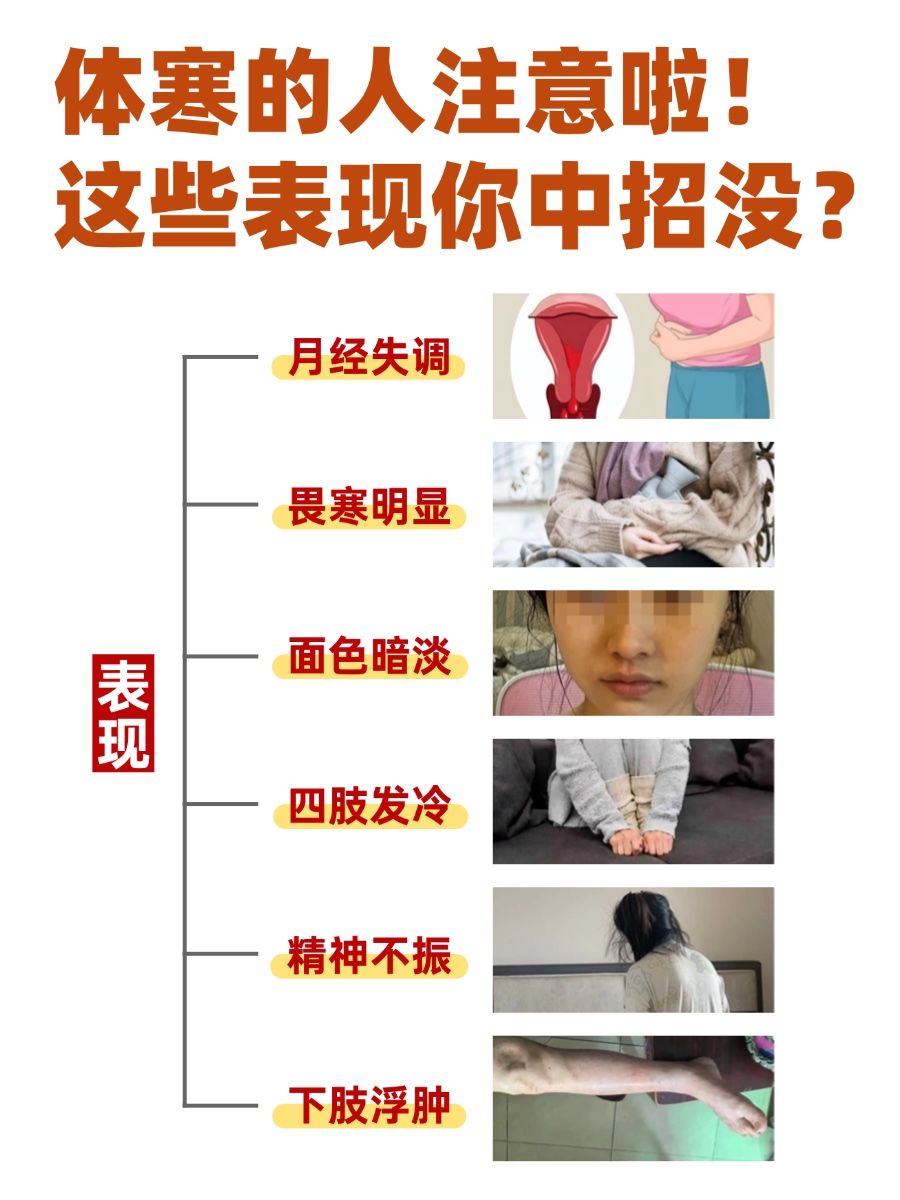 体寒的人注意啦！这些表现你中招没？