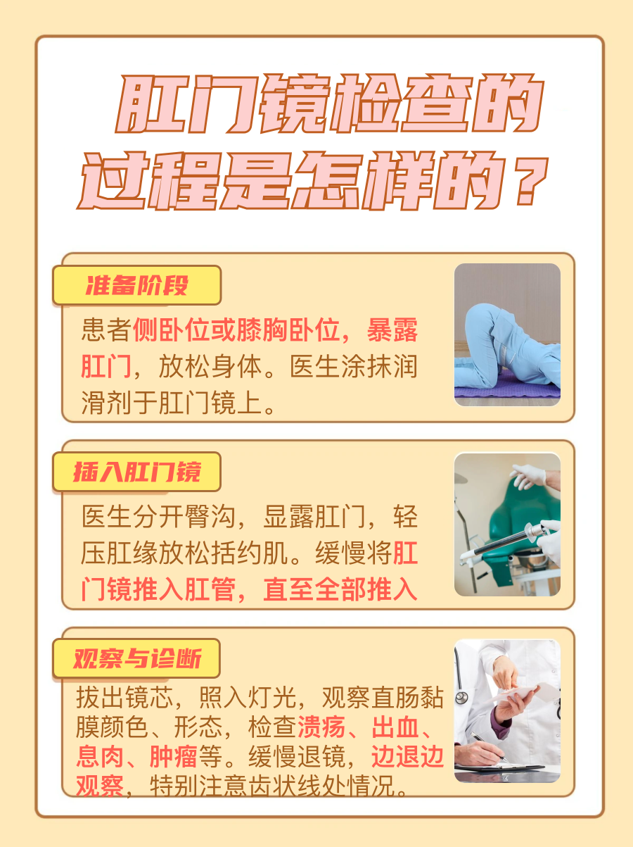肛门镜检查:了解肛肠健康的“窗口”