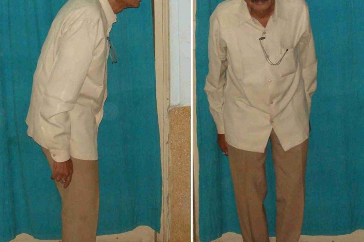 晚期髋关节屈曲图