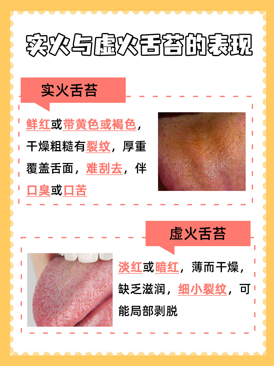 实火和虚火舌苔图