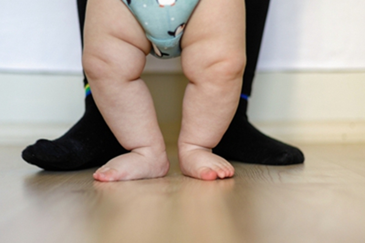 维生素D缺乏性佝偻病症状图 维生素D缺乏性佝偻病症状图