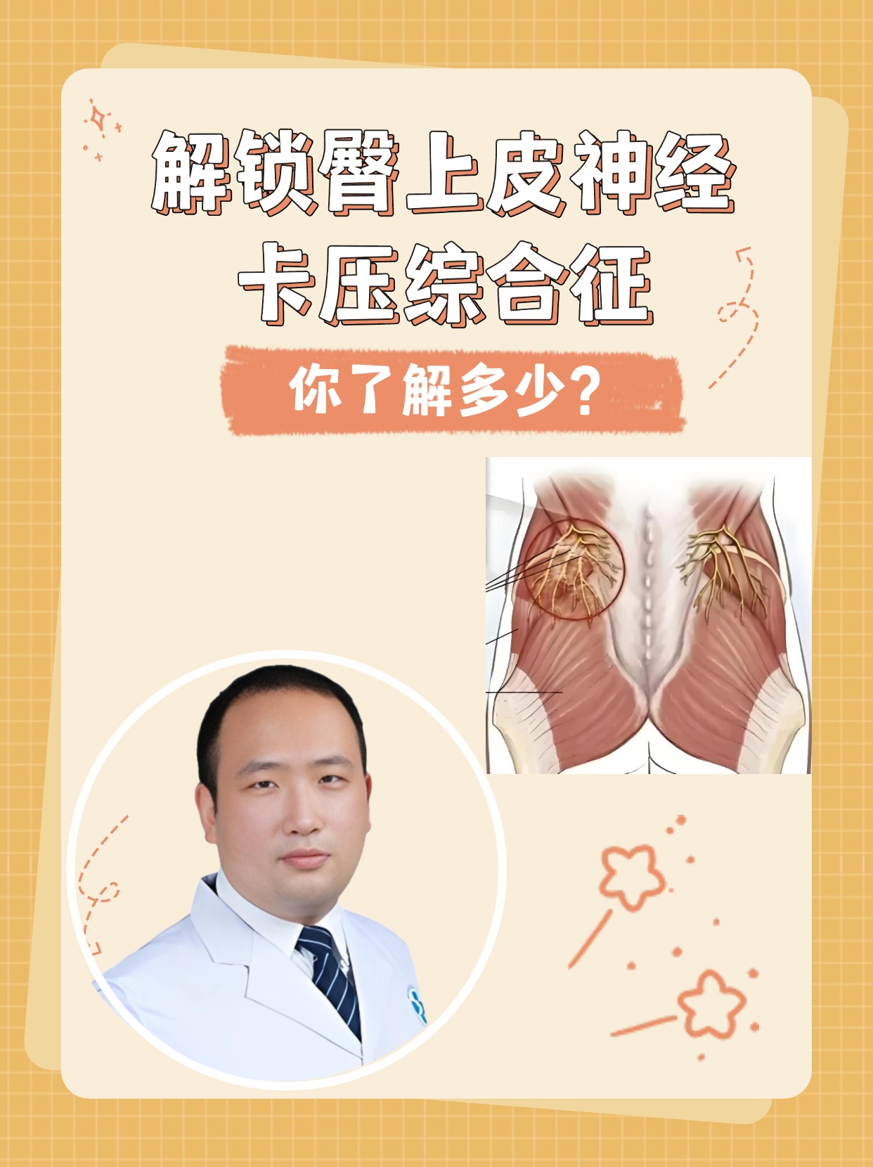 解锁臀上皮神经卡压综合征，你了解多少？