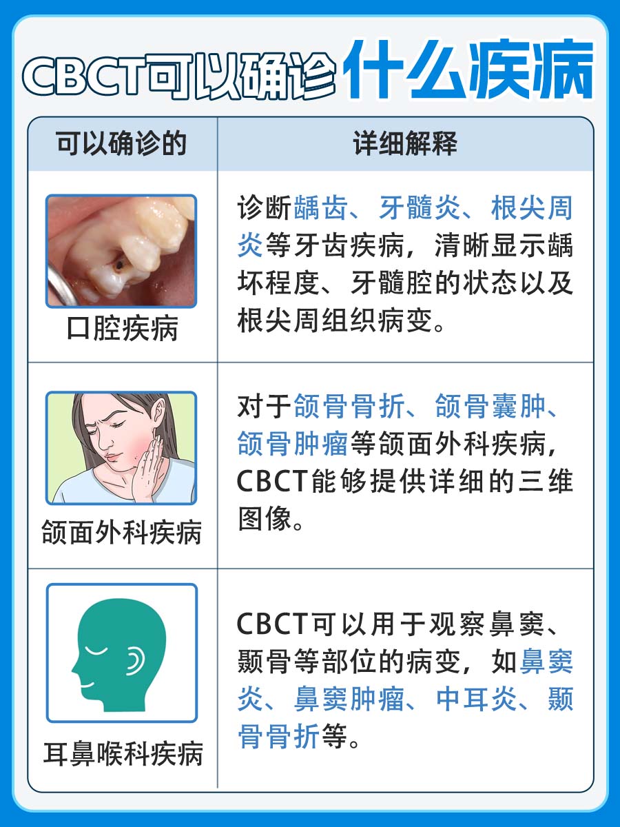 我来告诉你：CBCT是什么？