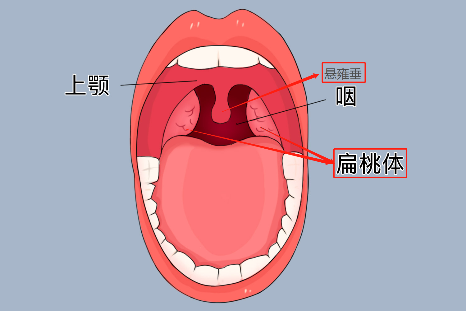 小舌头两侧扁桃体图