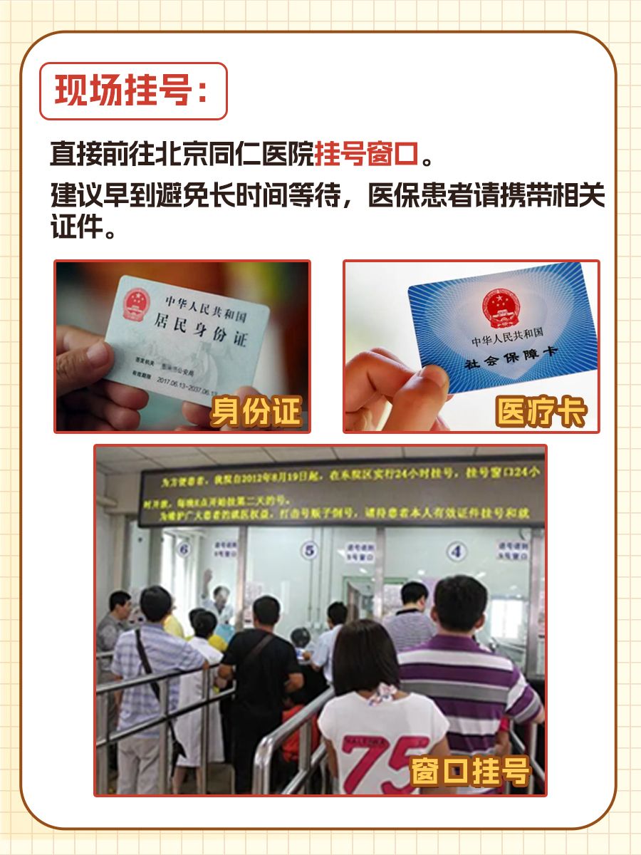 北京同仁医院王军医生怎么样？怎么挂号？