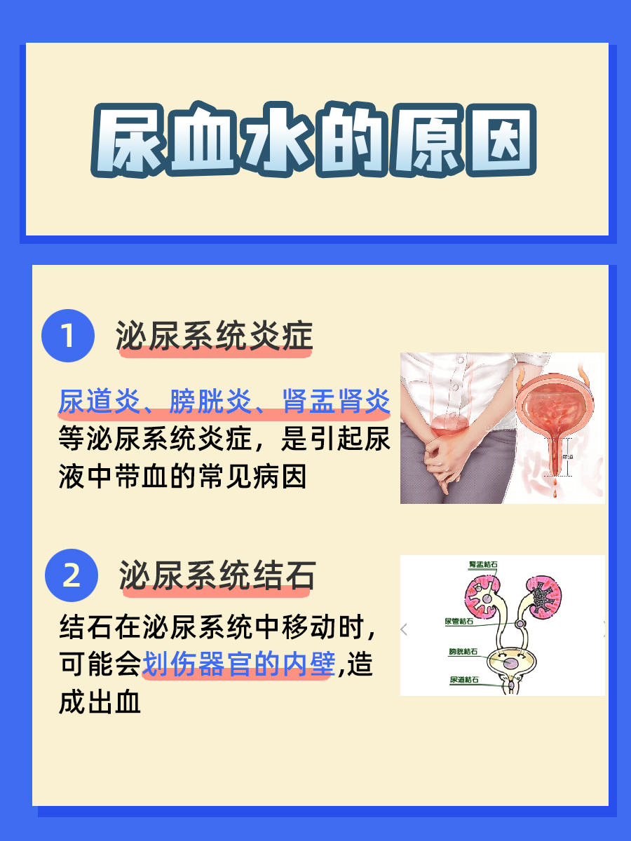 尿血水是什么原因？一文带你了解