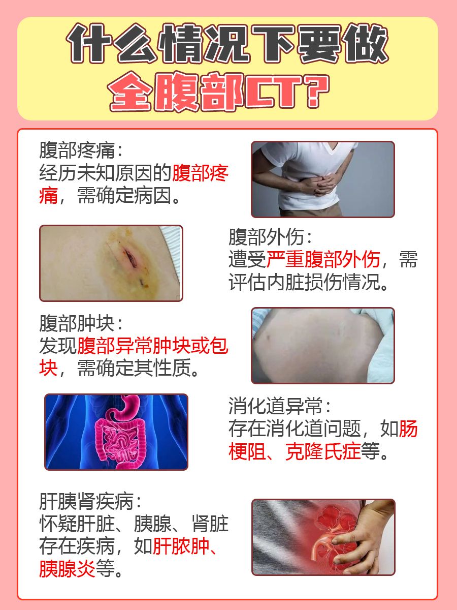 全腹部CT平扫查什么？后悔知道得太晚了