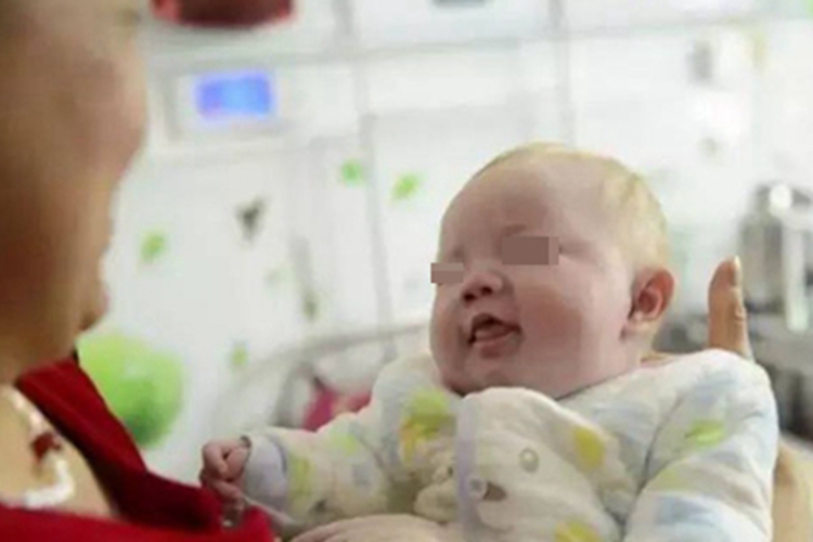 眼皮肤白化病头发发黄图