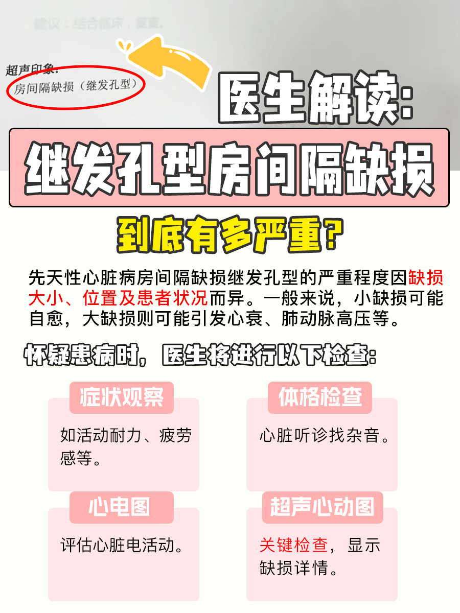 继发孔型房间隔缺损，点击查看其严重与否？
