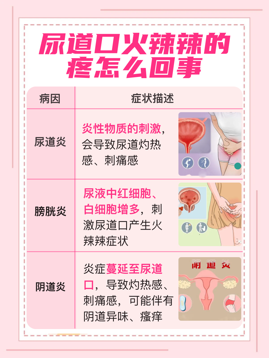 尿道口火辣痛？揭秘疼痛真相！