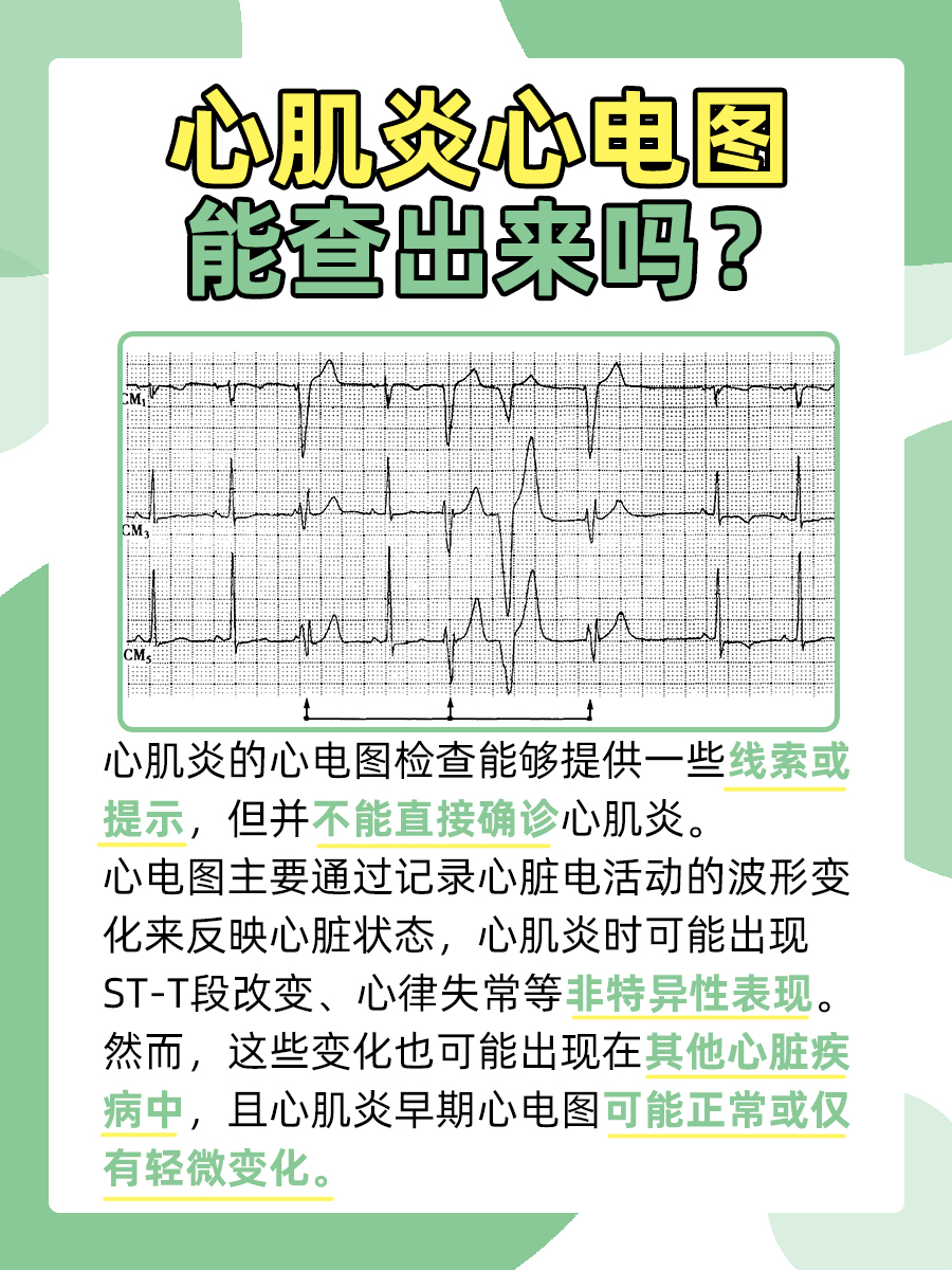 心电图知多少：心肌炎心电图能查出来吗？