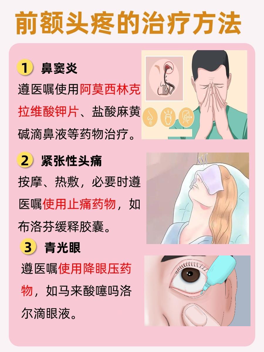 医生解答:前额头疼是怎么回事