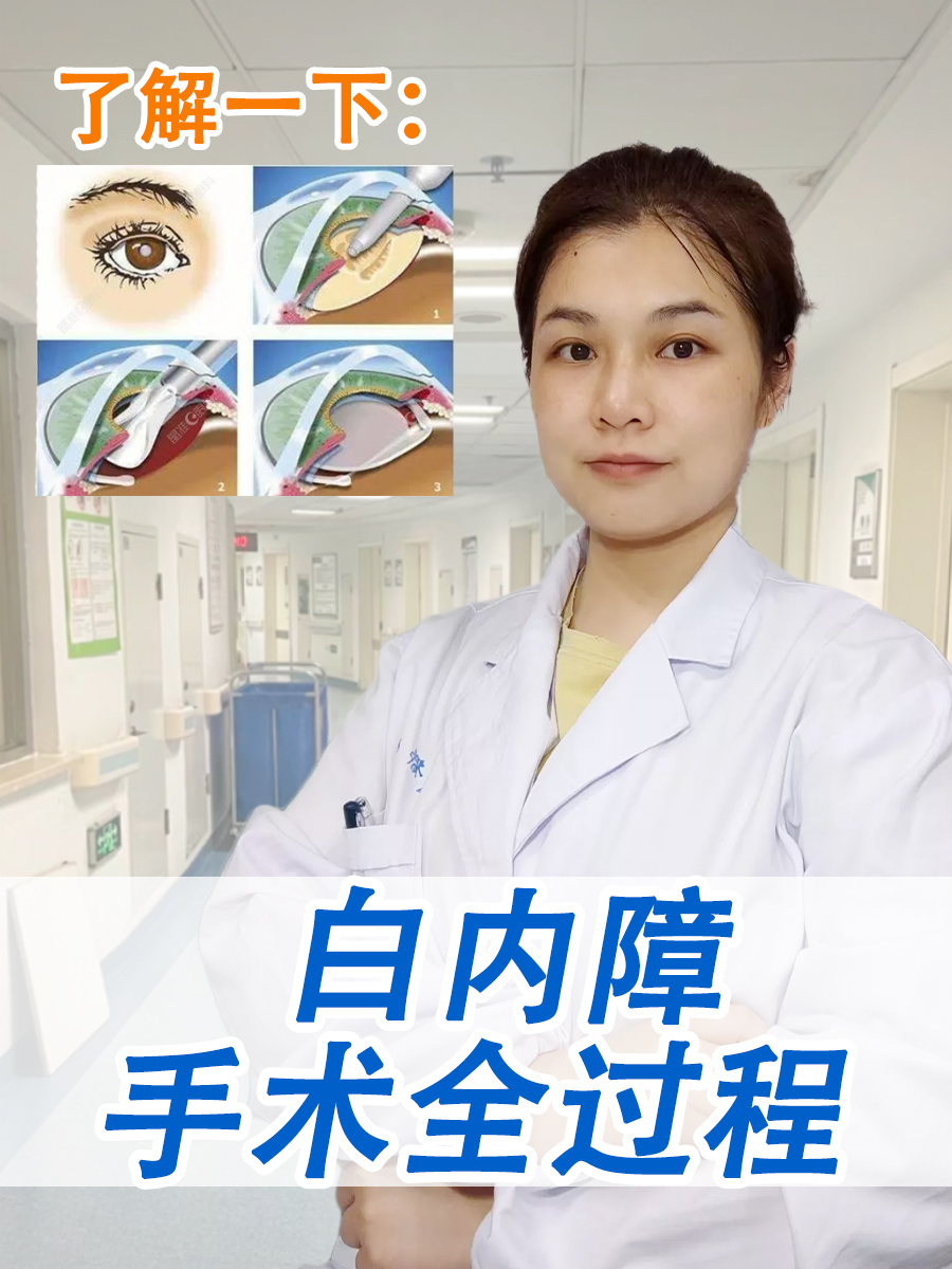 了解一下：白内障手术全过程