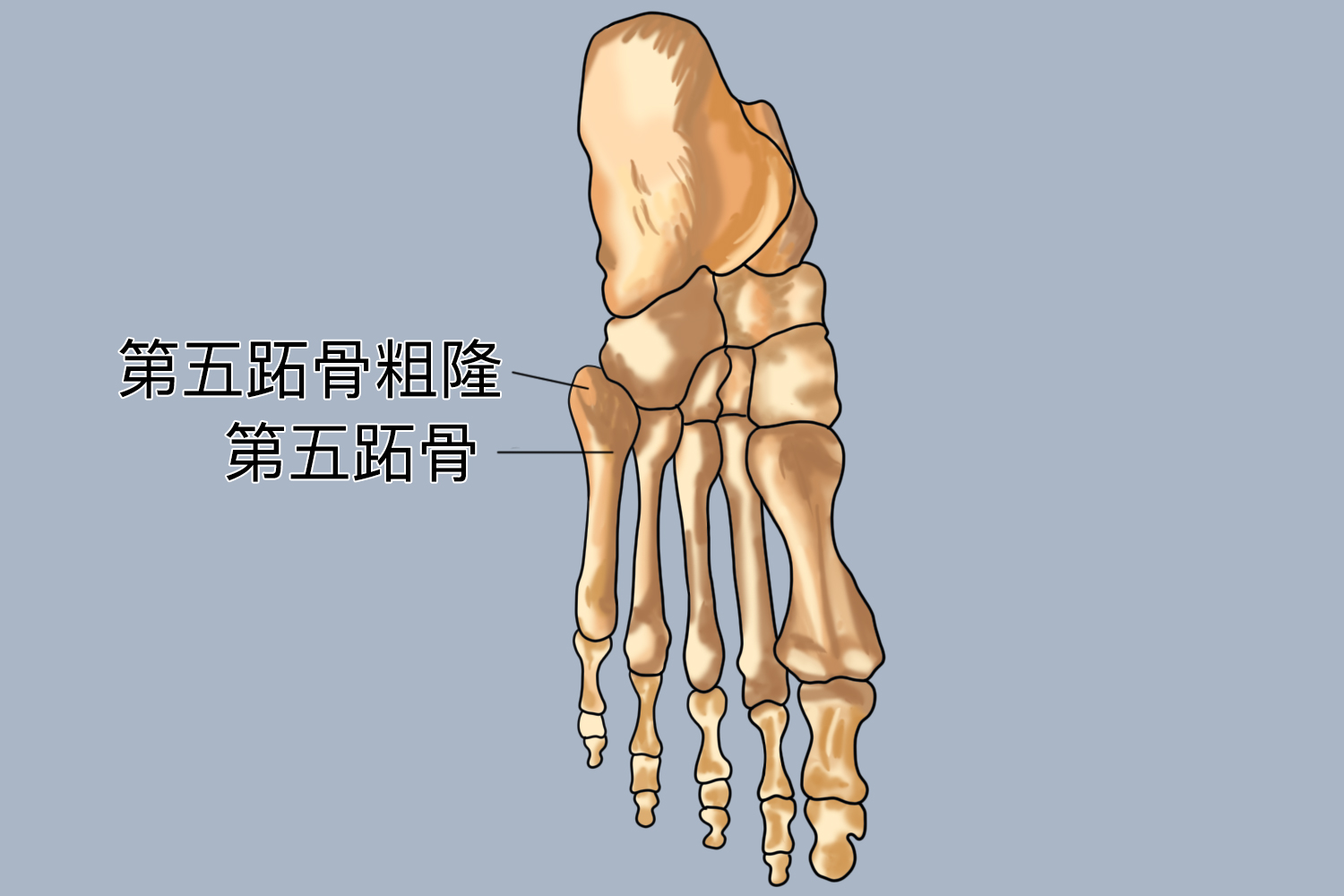右足第五跖骨位置图