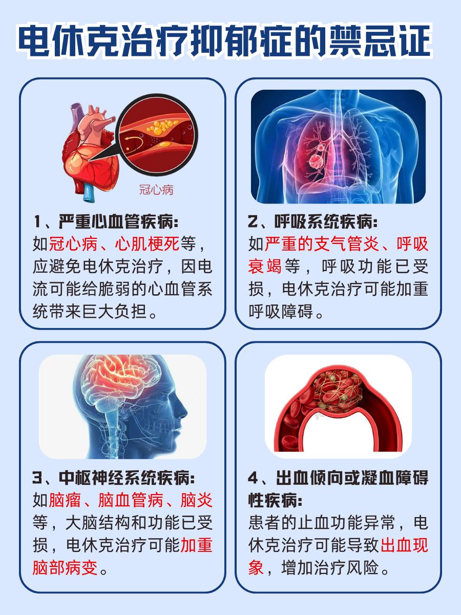 电休克三次，抑郁症真的能痊愈吗？
