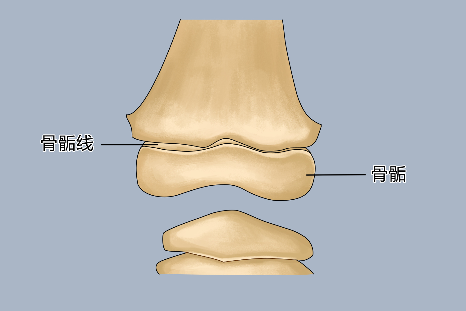 骨骺线未闭合图