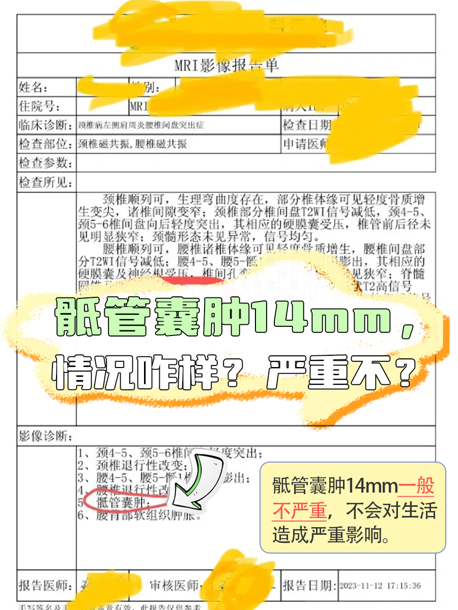 骶管囊肿14mm，情况咋样？严重不？