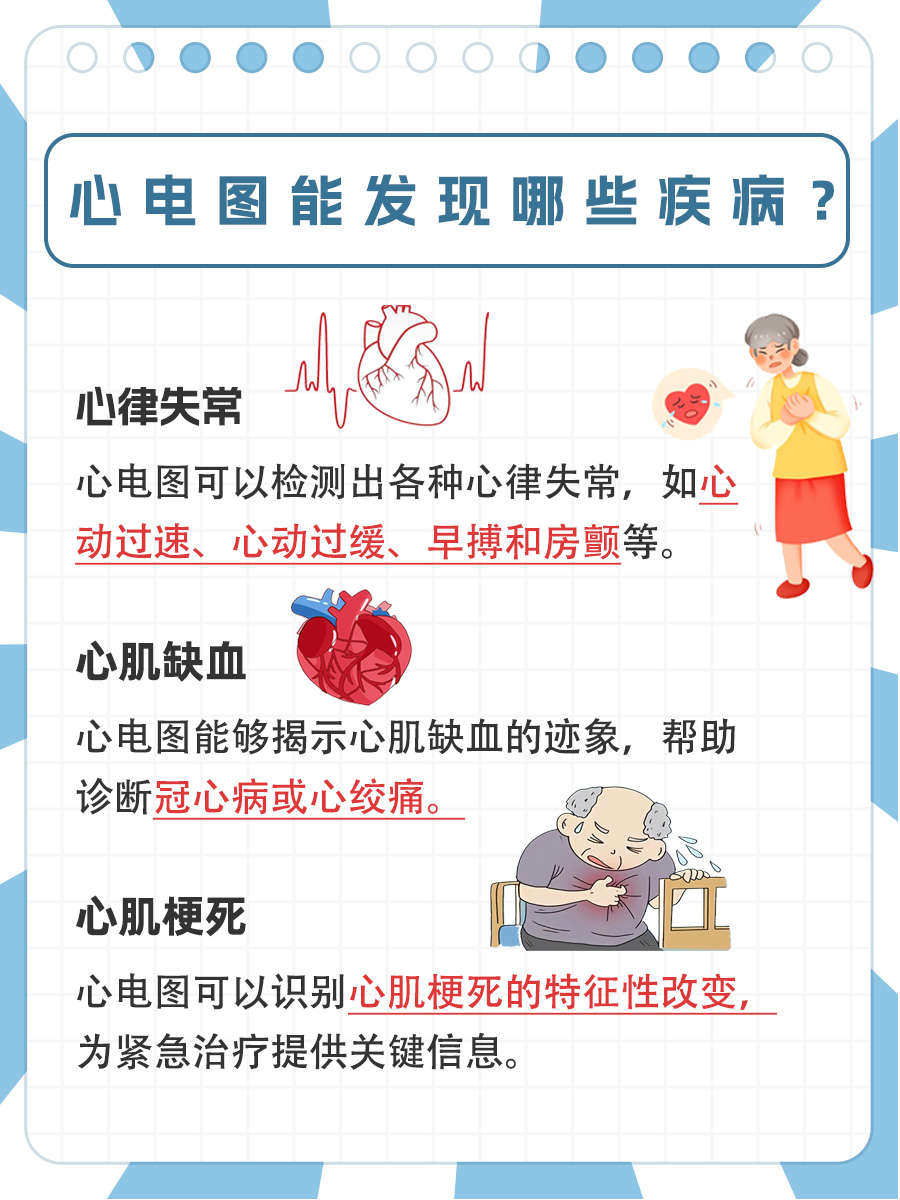 关注心脏健康，心电图多久出结果