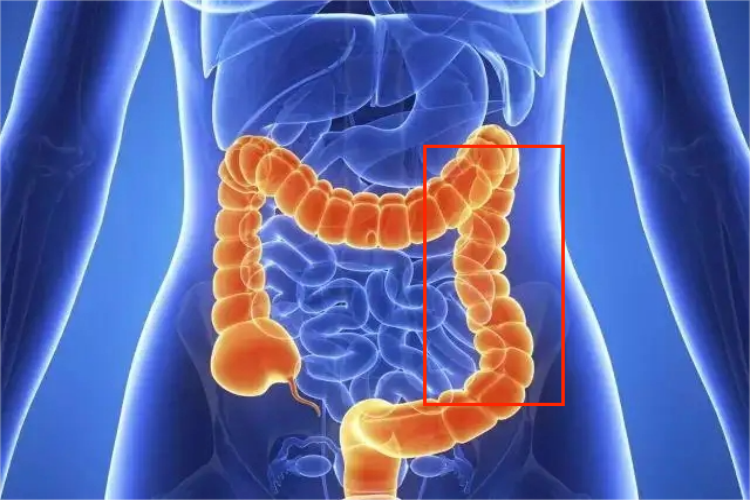 左结肠癌疼痛位置图
