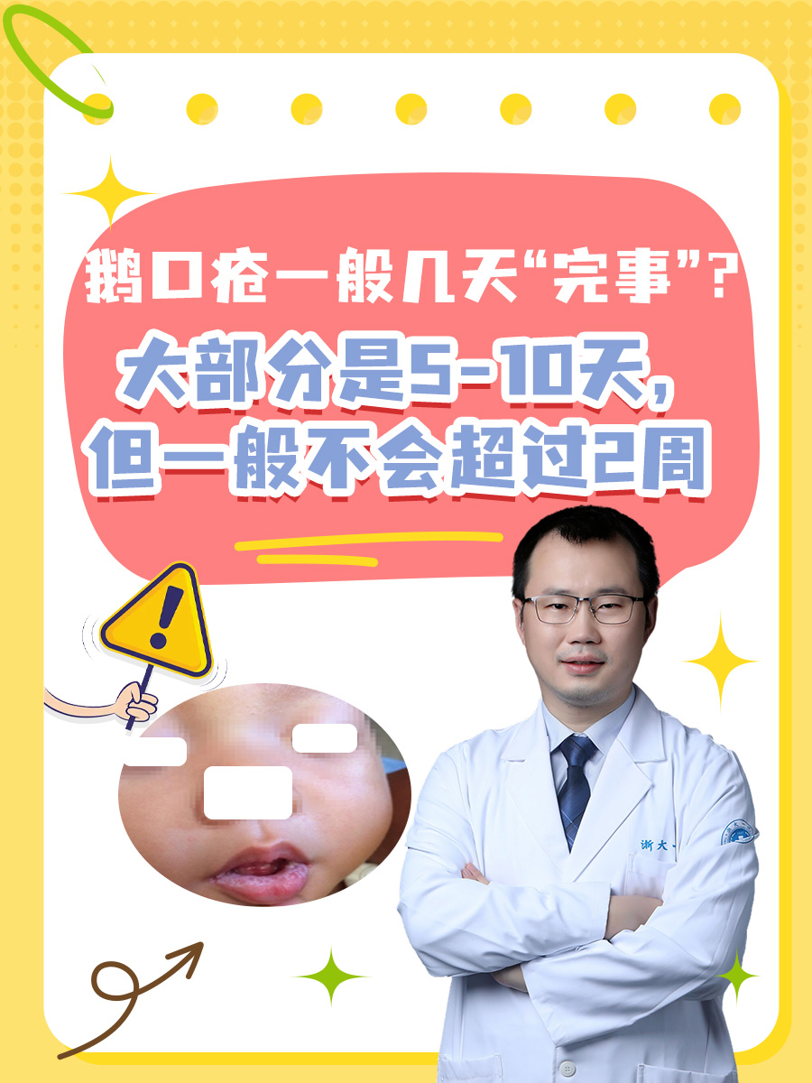 鹅口疮一般几天“完事”？