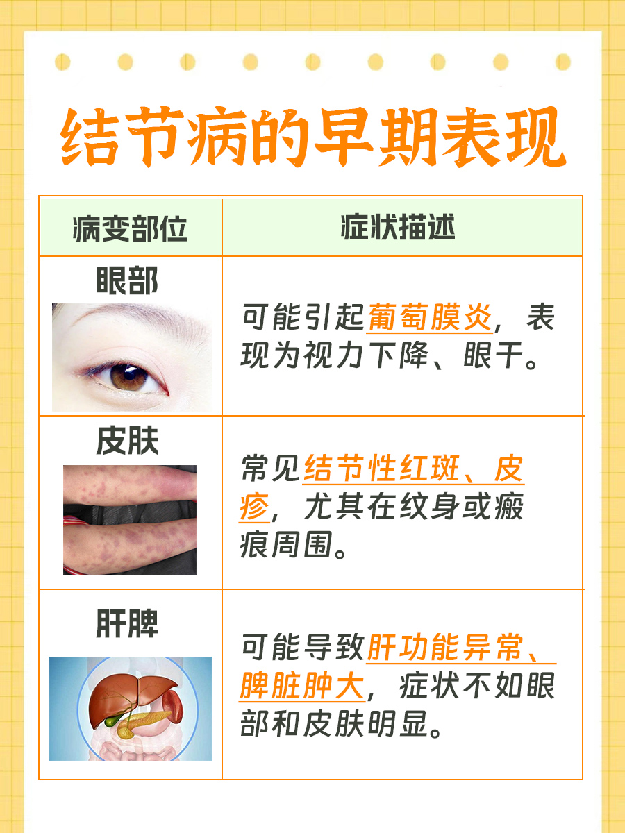 深度解析:结节病的早期表现是什么?