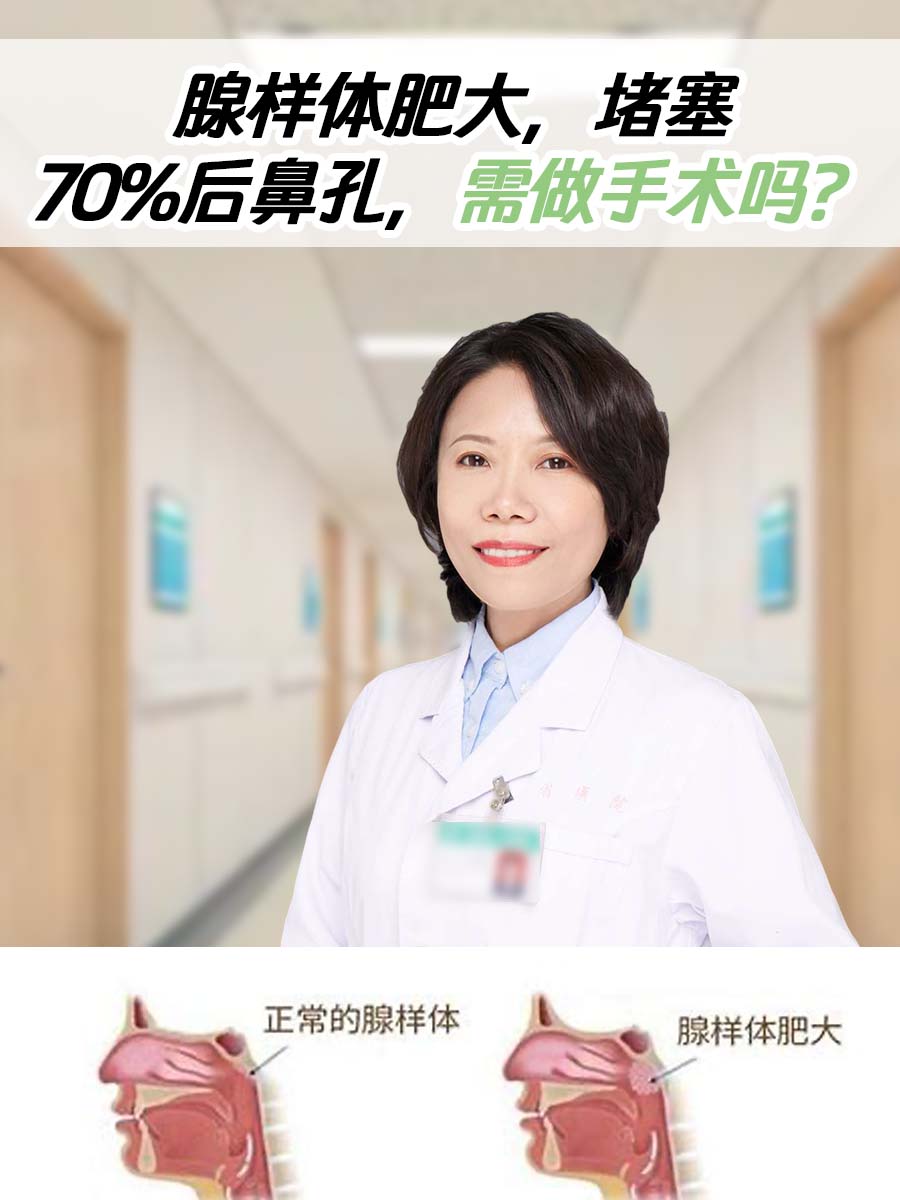 腺样体肥大，堵塞70%后鼻孔，需做手术吗？