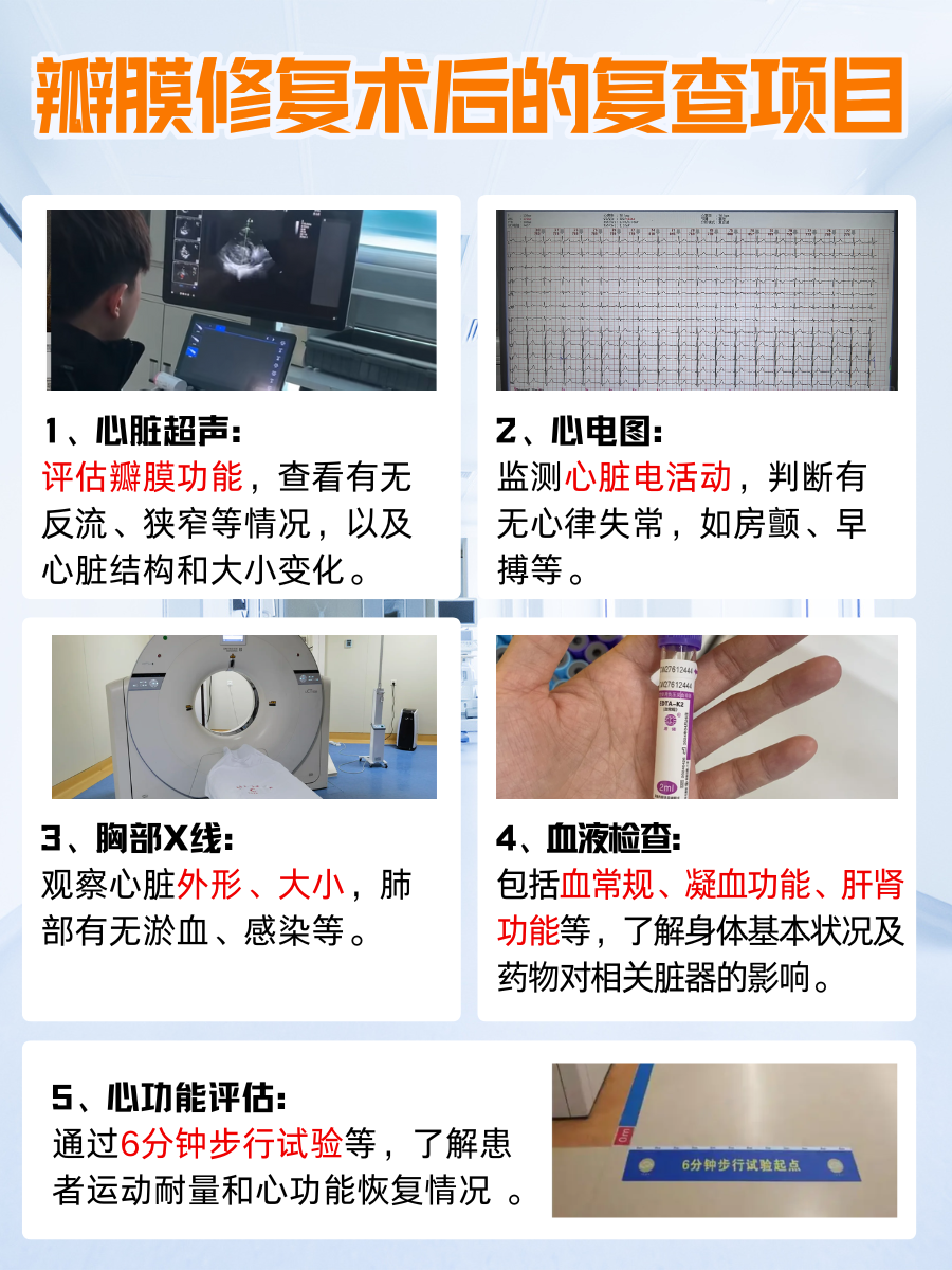 瓣膜修复术后能管多少年?答案出乎意料!