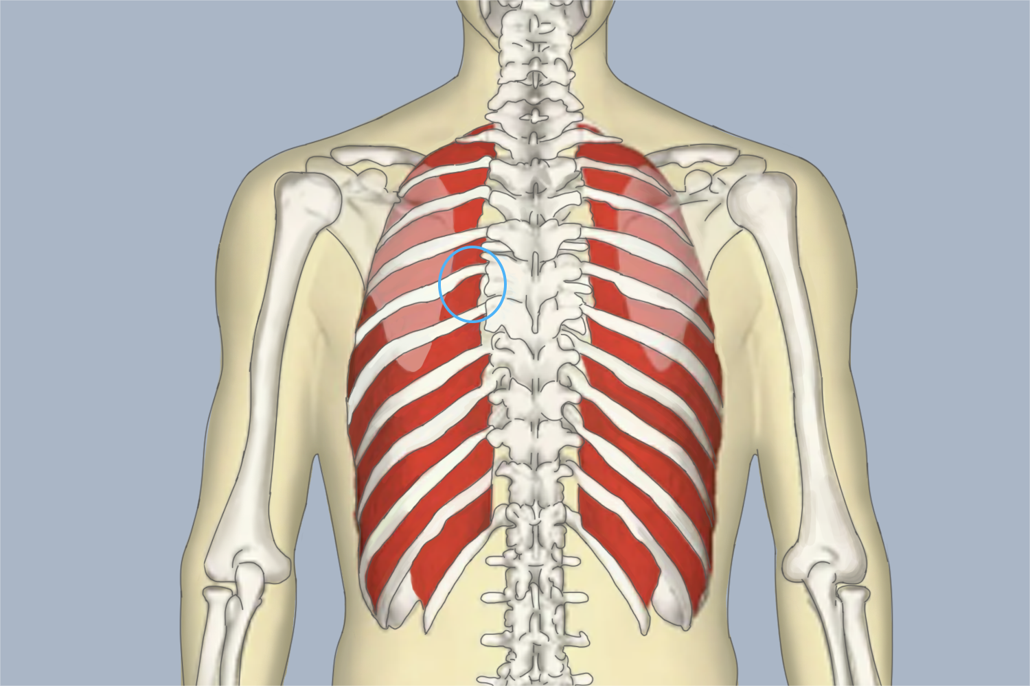 肺癌左侧后背疼痛图