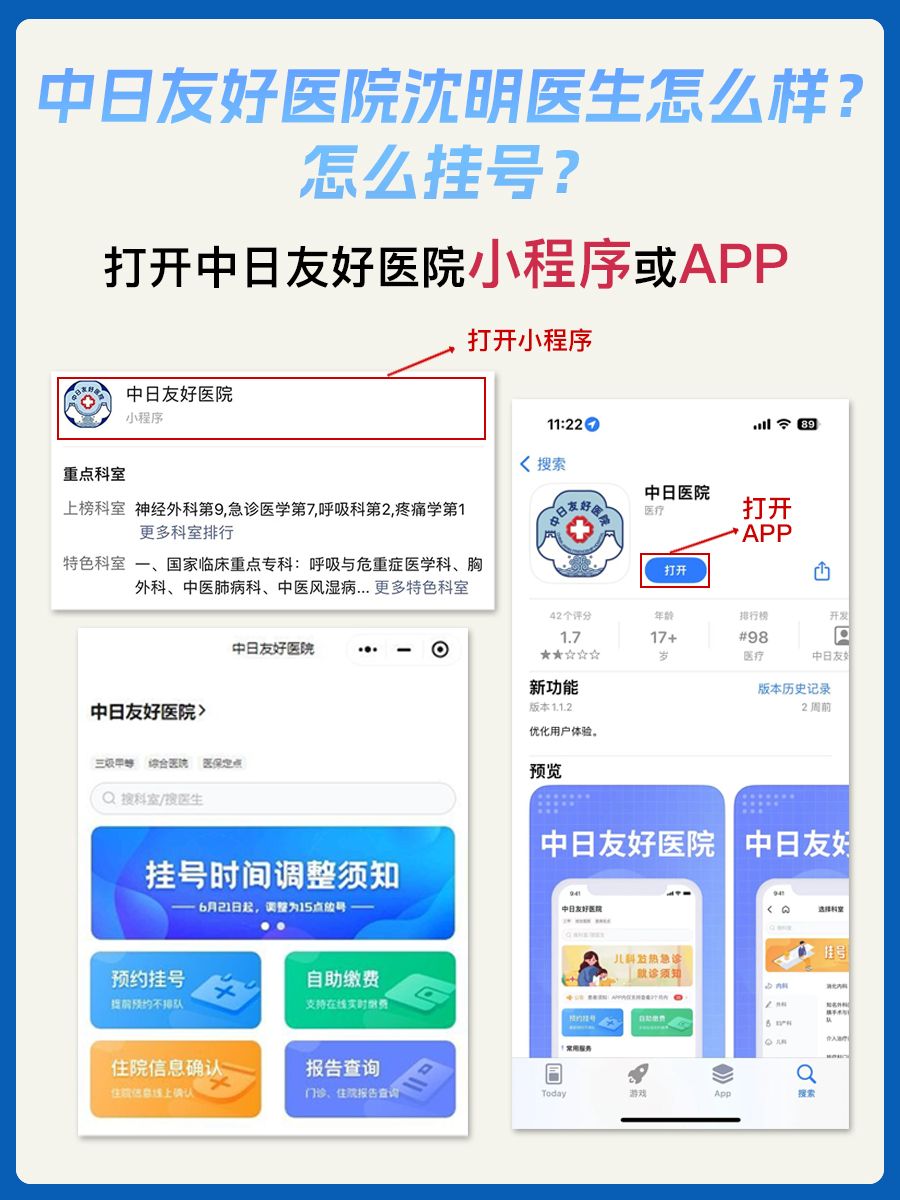中日友好医院沈明医生怎么样?怎么挂号?