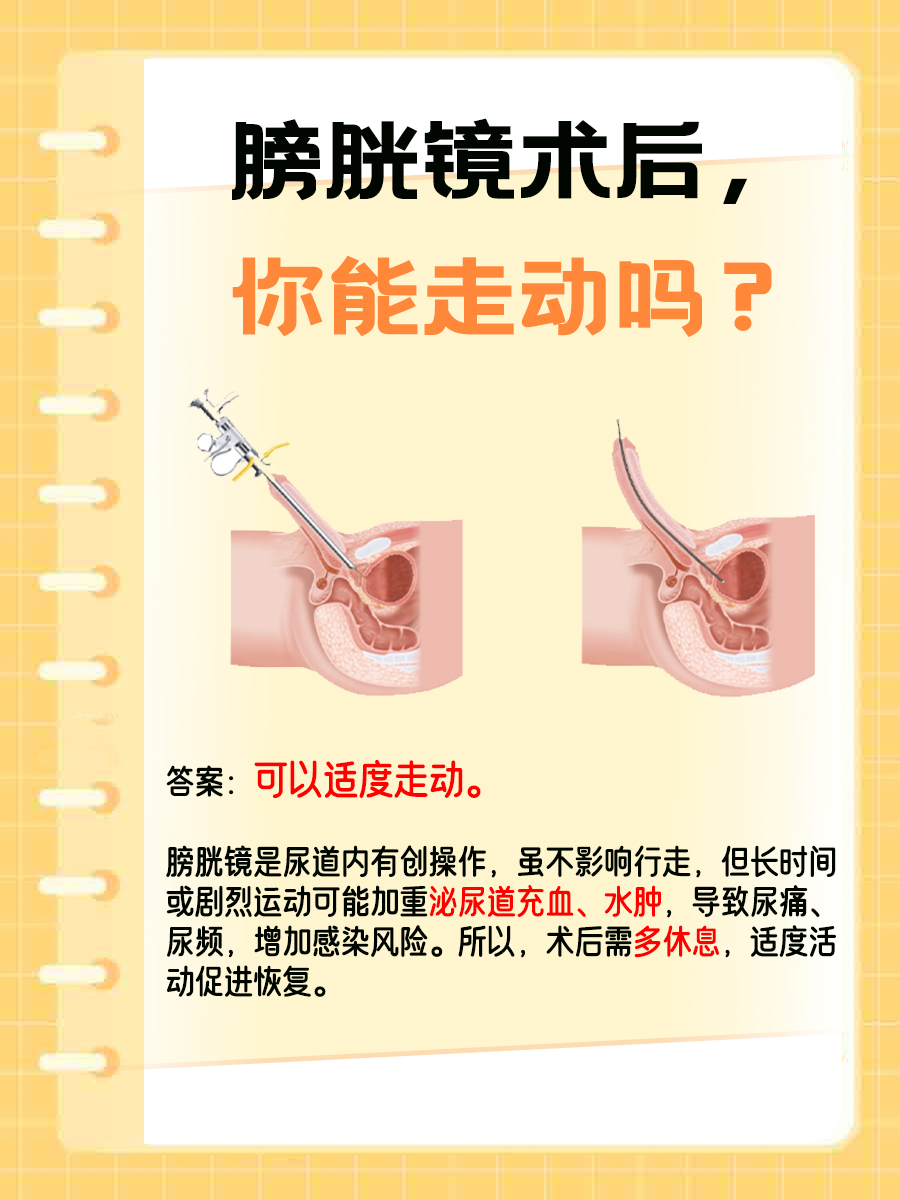 膀胱镜后,能不能走动?这里有你想要的答案!
