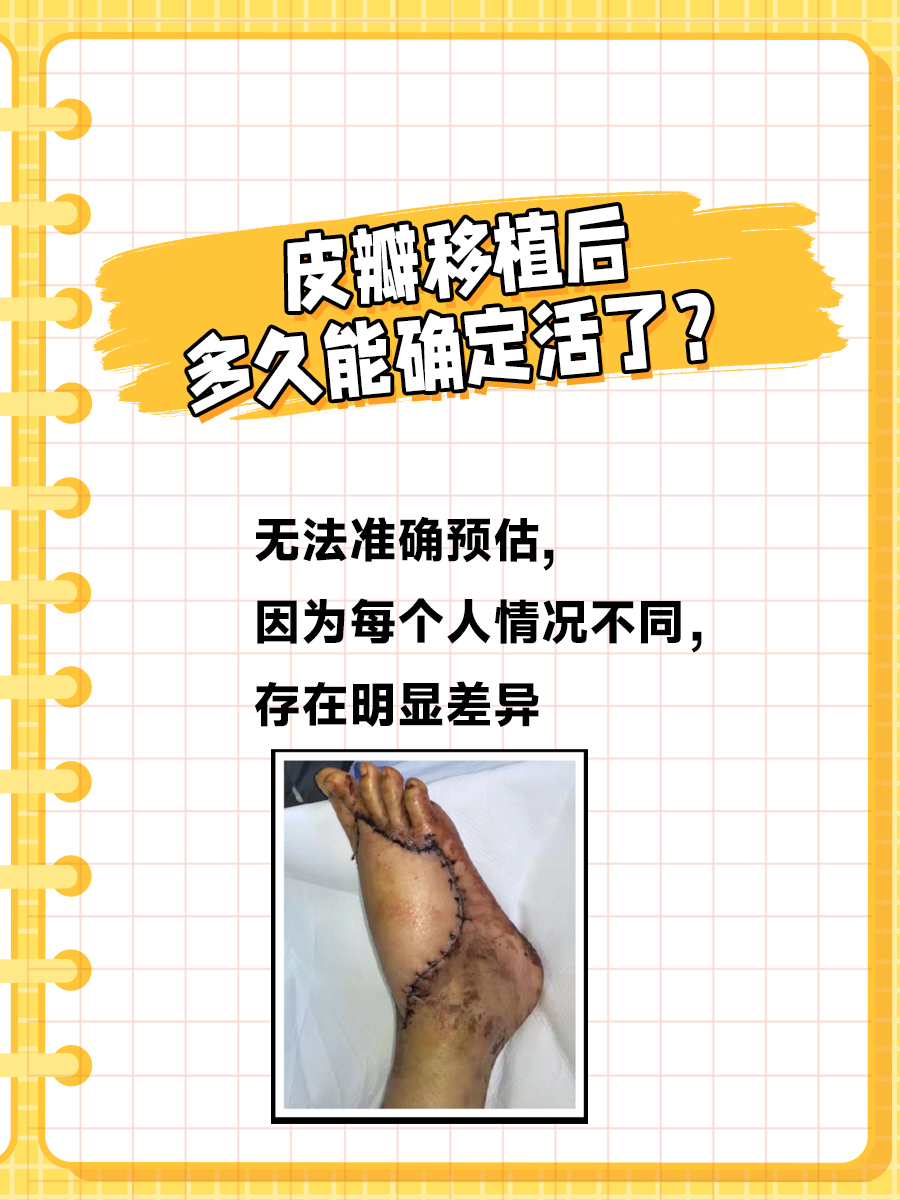 皮瓣移植大揭秘:究竟多久能“起死回生”?