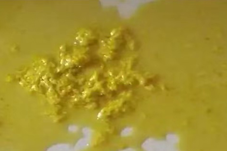 金黄色略带颗粒大便图