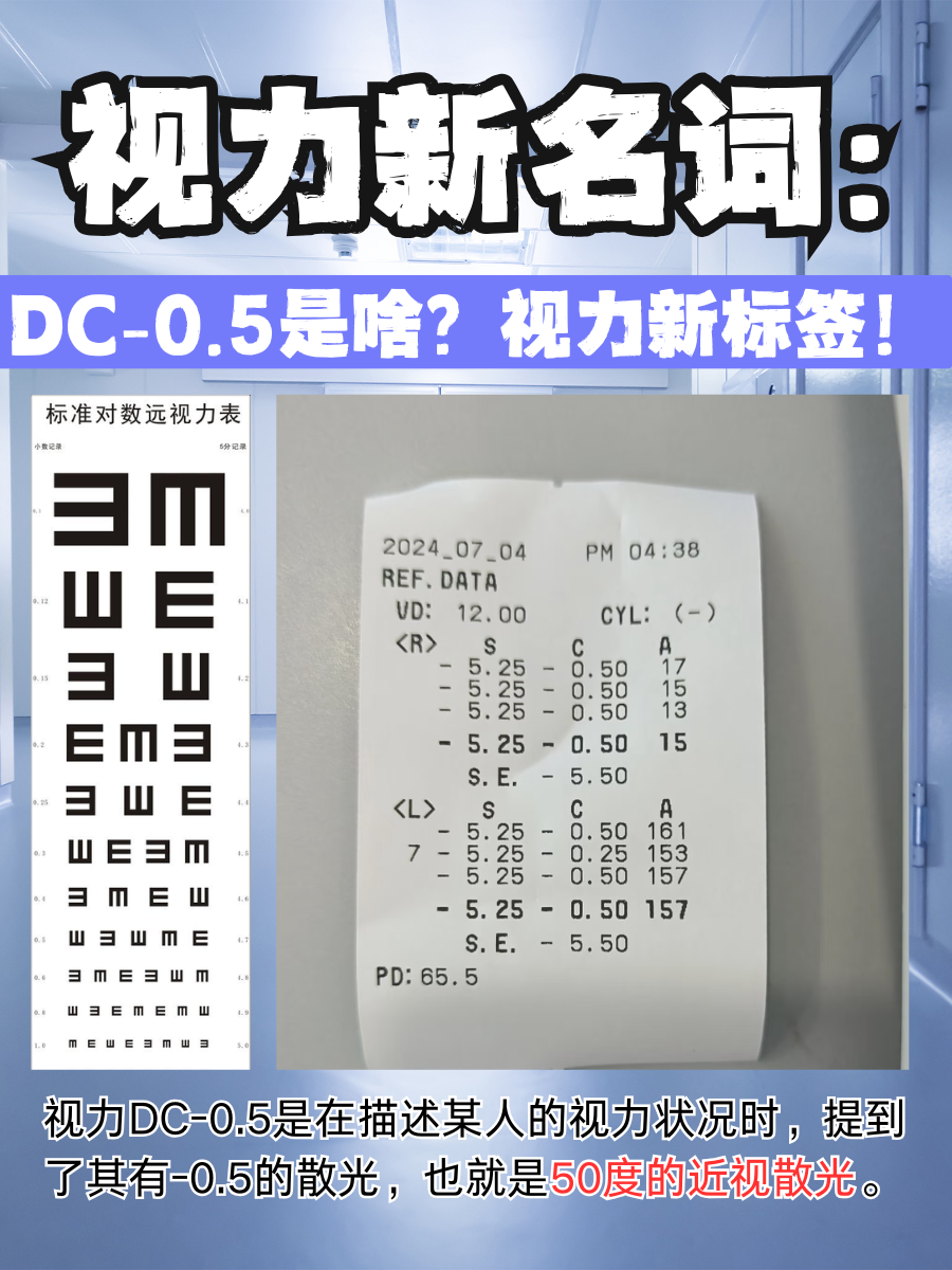 视力新名词：DC-0.5是啥？视力新标签！