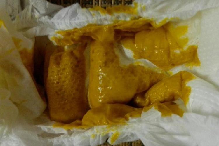 人乳喂养满月宝宝大便图