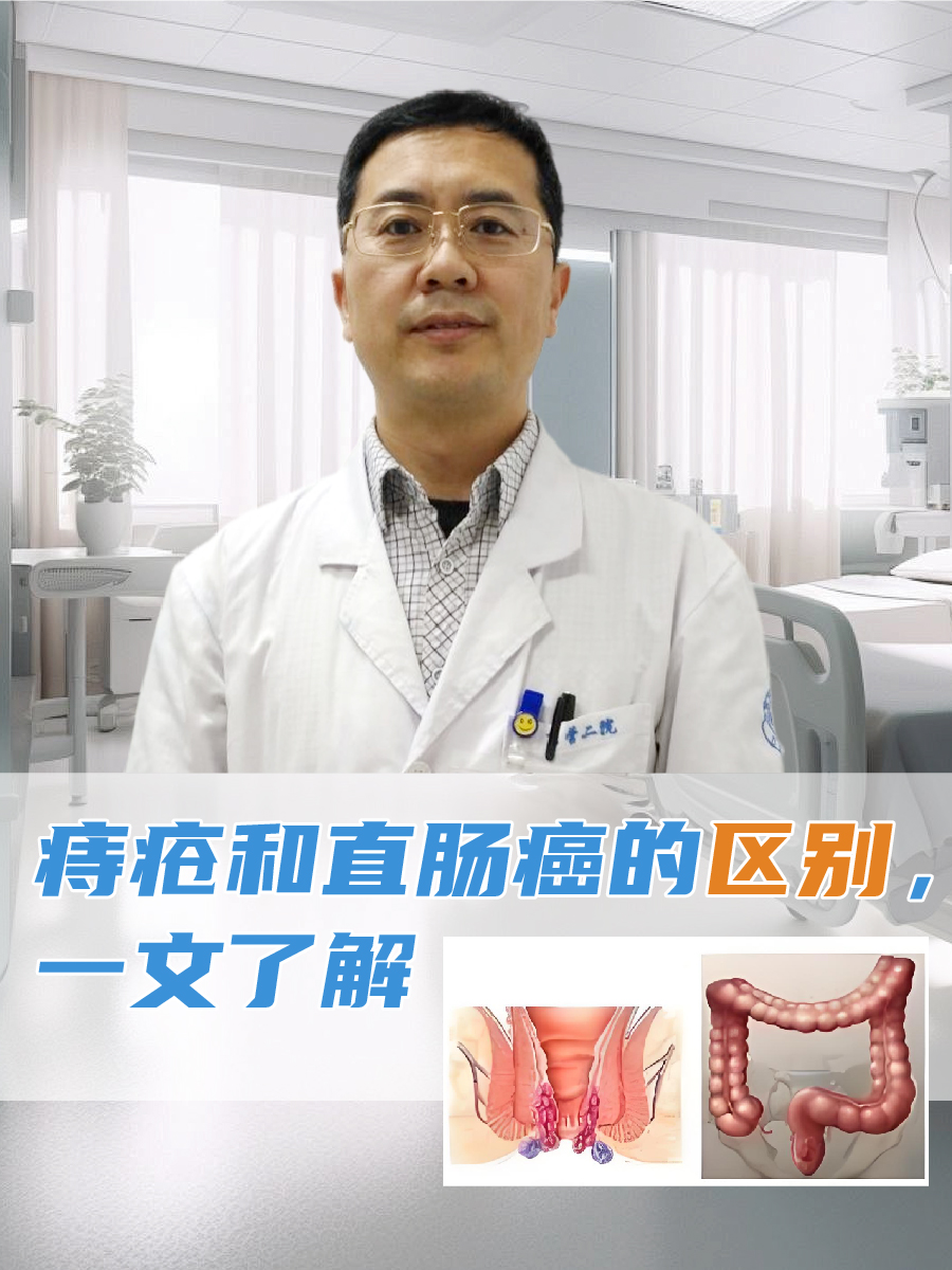 痔疮和直肠癌的区别,一文了解