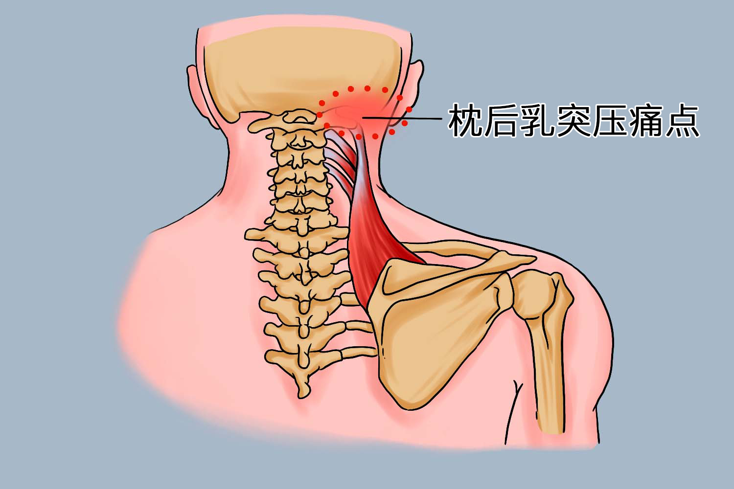 人体击打痛点的位置示意图_有来医生
