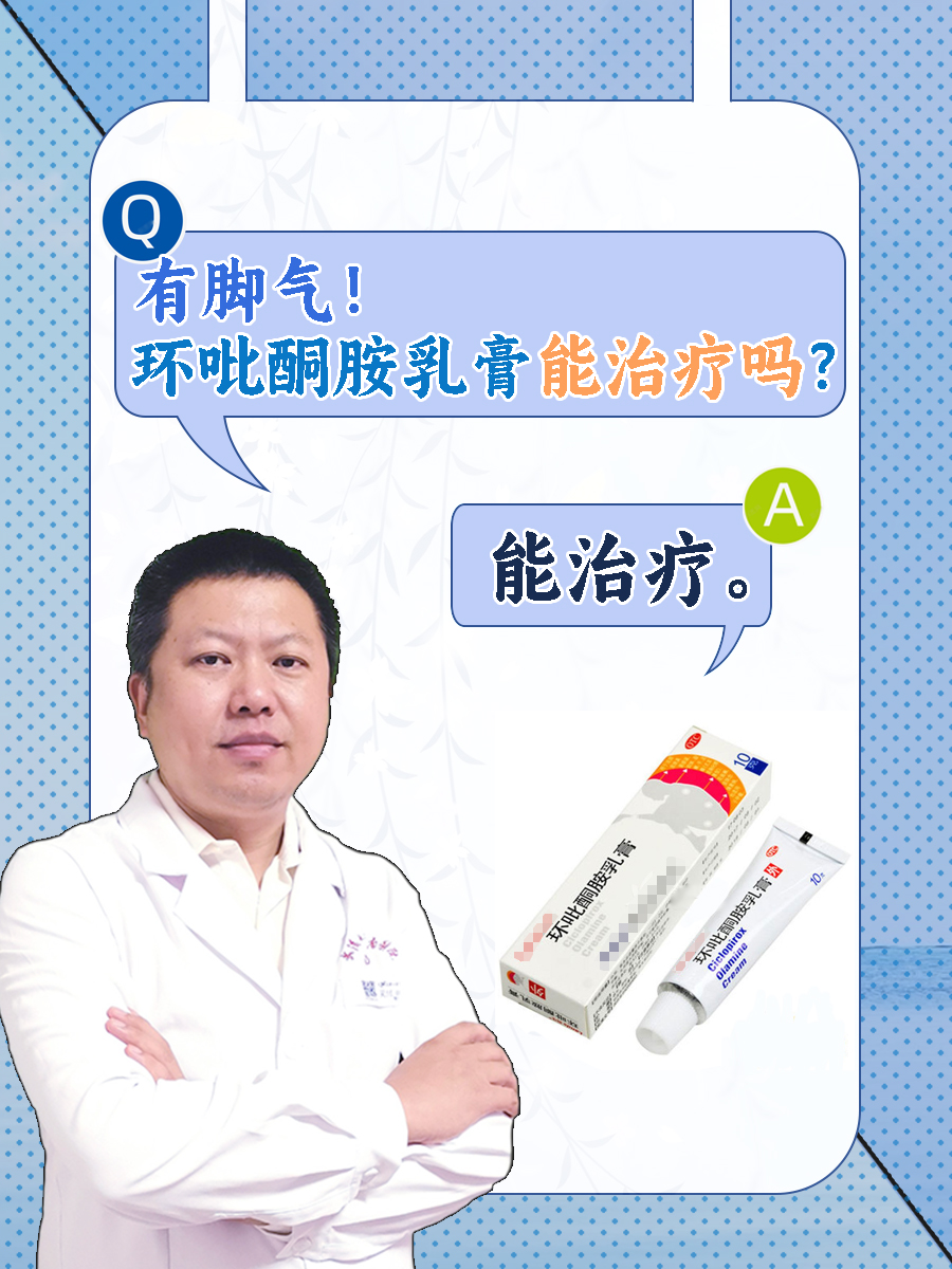 有脚气！环吡酮胺乳膏能治疗吗?