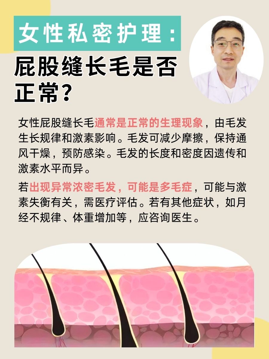 医生解答：女性屁股缝长毛是否正常？