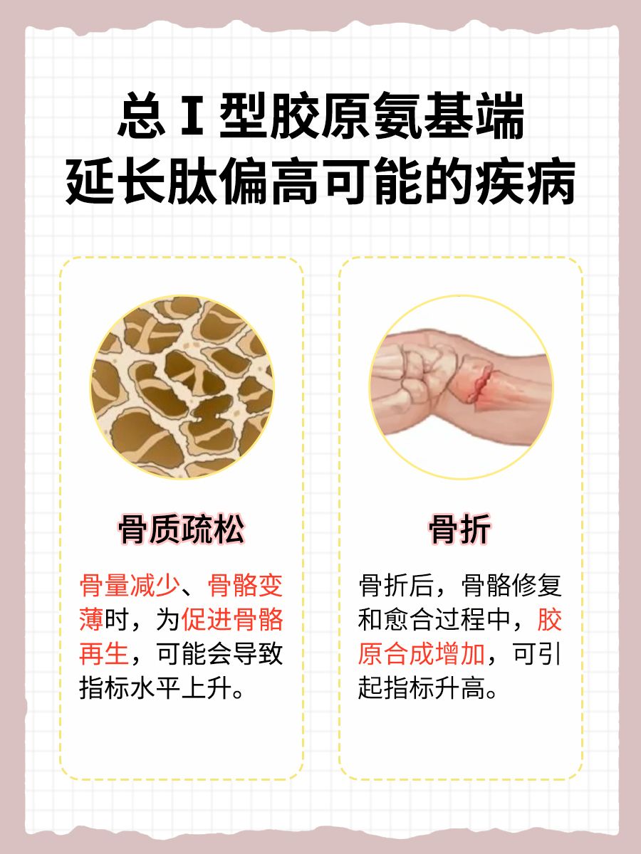总Ⅰ型胶原氨基端肽偏高，可能潜藏什么健康隐患？