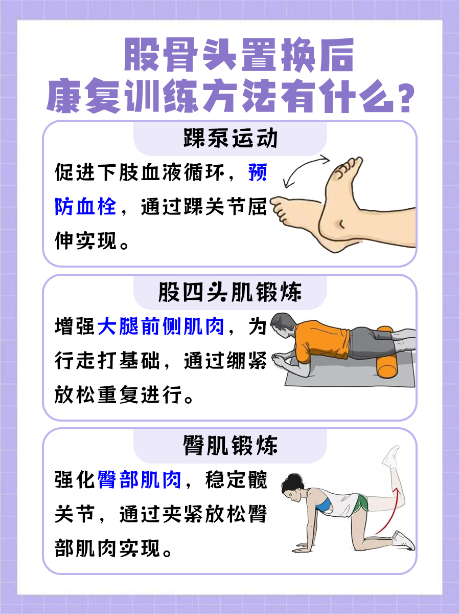 股骨头置换后康复训练方法，答案揭晓
