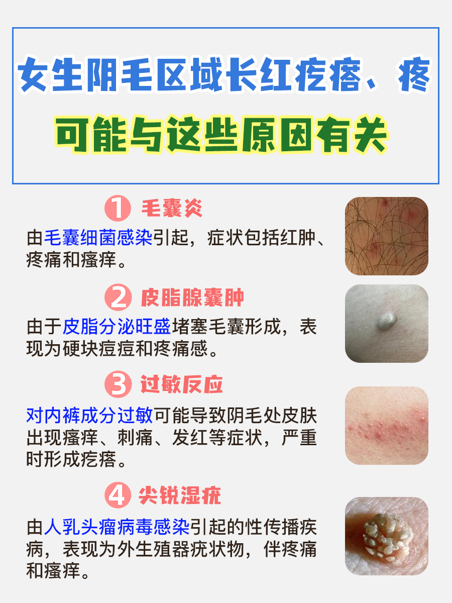 女生私密尴尬：毛毛区红疙瘩痛，原因在这里！